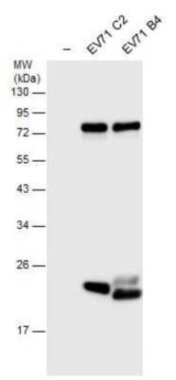 Enterovirus 71 3C Antibody, Novus Biologicals 100 &mu;g | Buy Online | Novus Biologicals | Fisher Scientific