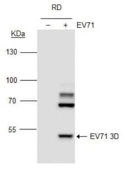 Enterovirus 71 3D Antibody (4), Novus Biologicals 100 &mu;g; Unconjugated:Antibodies,