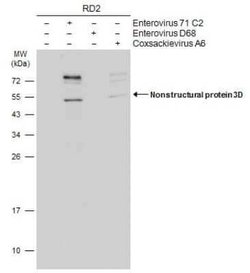 Enterovirus 71 3D Antibody (4), Novus Biologicals 100 &mu;g; Unconjugated:Antibodies,