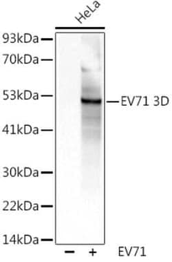 Enterovirus 71 3D Rabbit anti-Virus, Polyclonal, Novus Biologicals 20 &mu;g | Buy Online | Novus Biologicals | Fisher Scientific
