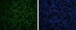 Enterovirus 71 VP1 Antibody, Novus Biologicals 100 &mu;g | Buy Online | Novus Biologicals | Fisher Scientific