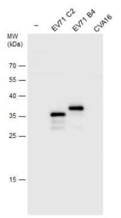 Enterovirus 71 VP1 Antibody, Novus Biologicals 100 &mu;g | Buy Online | Novus Biologicals | Fisher Scientific