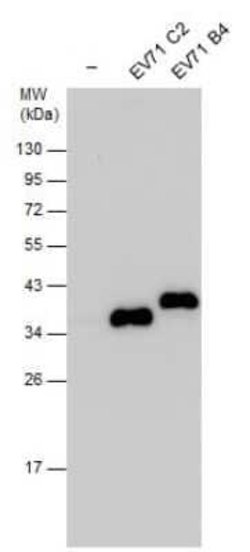 Enterovirus 71 VP1 Antibody, Novus Biologicals 100 μg; Unconjugated:Antibodies,