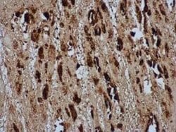 Enterovirus 71 VP2 Antibody, Novus Biologicals 100 &mu;g | Buy Online | Novus Biologicals | Fisher Scientific