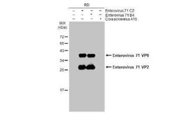Enterovirus 71 VP2 Antibody, Novus Biologicals 100 &mu;g | Buy Online | Novus Biologicals | Fisher Scientific