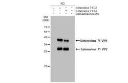 Enterovirus 71 VP2 Antibody, Novus Biologicals 100 &mu;g | Buy Online | Novus Biologicals | Fisher Scientific