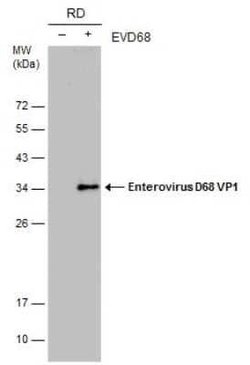 Enterovirus D68 VP1 Antibody (GT11610), Novus Biologicals 100 &mu;g | Buy Online | Bio-Techne | Fisher Scientific