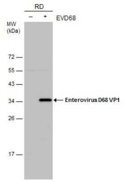 Enterovirus D68 VP1 Antibody (GT1843), Novus Biologicals 100 &mu;g | Buy Online | Bio-Techne | Fisher Scientific