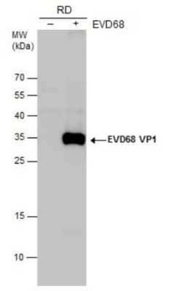 Enterovirus D68 VP1 Antibody, Novus Biologicals 100 &mu;g | Buy Online | Novus Biologicals | Fisher Scientific