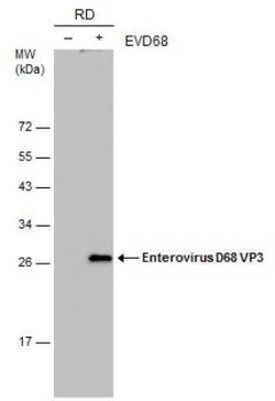 Enterovirus D68 VP3 Antibody (GT1665), Novus Biologicals 100 &mu;g | Buy Online | Novus Biologicals | Fisher Scientific