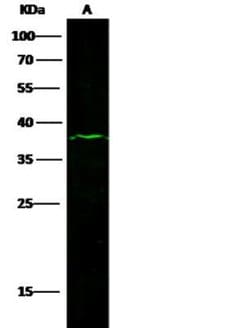 EpCAM/TROP1 Rabbit anti-Mouse, Clone: 2, Novus Biologicals 50 &mu;g; Unconjugated:Antibodies,
