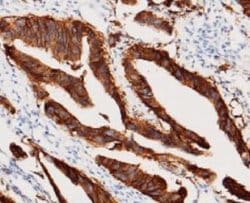 EpCAM/TROP1 Rabbit anti-Human, Clone: 28, Novus Biologicals:Antibodies:Primary