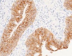 EpCAM/TROP1 Rabbit anti-Human, Clone: 28, Novus Biologicals:Antibodies:Primary