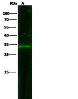 EpCAM/TROP1 Rabbit anti-Human, Clone: 28, Novus Biologicals:Antibodies:Primary