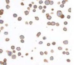 EpCAM/TROP1 Antibody (BLR077G), Novus Biologicals 100 &mu;g; Unconjugated:Antibodies,
