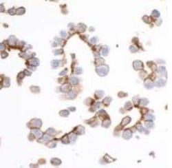 EpCAM/TROP1 Antibody (BLR077G), Novus Biologicals 100 &mu;g; Unconjugated:Antibodies,