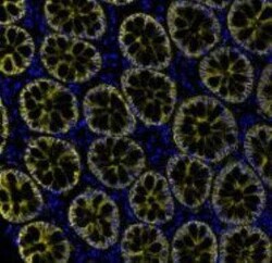 EpCAM/TROP1 Antibody (BLR077G), Novus Biologicals 100 &mu;g; Unconjugated:Antibodies,