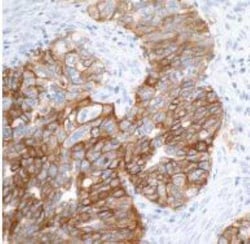 EpCAM/TROP1 Antibody (BLR077G), Novus Biologicals 100 &mu;g; Unconjugated:Antibodies,