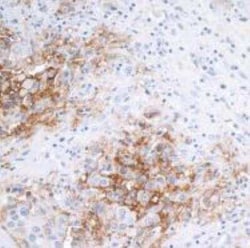 EpCAM/TROP1 Antibody (BLR077G), Novus Biologicals 100 &mu;g; Unconjugated:Antibodies,