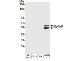 EpCAM/TROP1 Antibody (BLR077G), Novus Biologicals 100 &mu;g; Unconjugated:Antibodies,