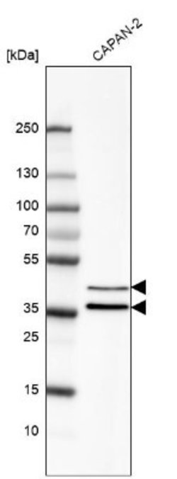 EpCAM/TROP1 Antibody (CL6259), Novus Biologicals 100 &mu;L | Buy Online | Novus Biologicals | Fisher Scientific