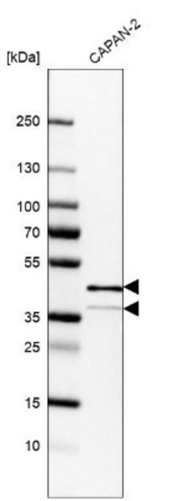 EpCAM/TROP1 Antibody (CL6313), Novus Biologicals:Antibodies:Primary Antibodies