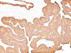 EpCAM/TROP1 Mouse, Clone: 323/A3, Novus Biologicals:Antibodies:Primary