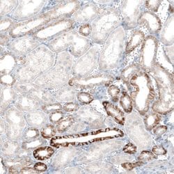 EpCAM/TROP1 Antibody (CL6259), Novus Biologicals 100 &mu;L | Buy Online | Novus Biologicals | Fisher Scientific