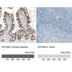 EpCAM/TROP1 Antibody (CL6313), Novus Biologicals:Antibodies:Primary Antibodies