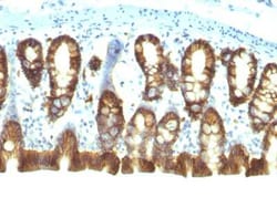EpCAM/TROP1 Antibody (EGP40/1110) - (ECD) - Azide and BSA Free, Novus Biologicals:Antibodies:Primary