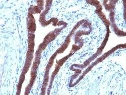 EpCAM/TROP1 Antibody (EGP40/1110) - (ECD), Novus Biologicals:Antibodies:Primary