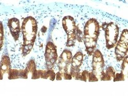 EpCAM/TROP1 Antibody (EGP40/1110) - (ECD), Novus Biologicals:Antibodies:Primary