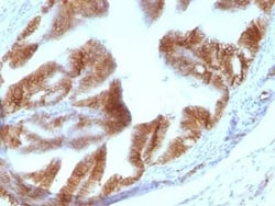 EpCAM/TROP1 Antibody (EGP40/1110) - (ECD), Novus Biologicals:Antibodies:Primary