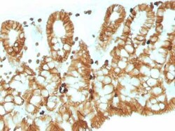 EpCAM/TROP1 Antibody (EGP40/1110) - (ECD), Novus Biologicals:Antibodies:Primary
