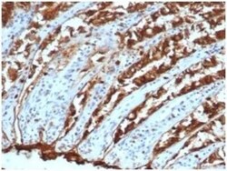 EpCAM/TROP1 Antibody (EGP40/1110) - (ECD), Novus Biologicals:Antibodies:Primary