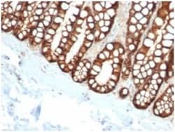 EpCAM/TROP1 Antibody (EGP40/1110) - (ECD), Novus Biologicals:Antibodies:Primary