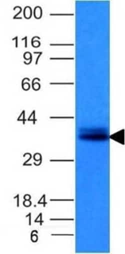 EpCAM/TROP1 Antibody (EGP40/1120) - (ECD), Novus Biologicals 0.1mg; Unlabeled:Antibodies,