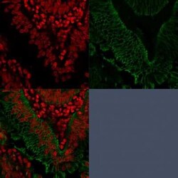 EpCAM/TROP1 Antibody (EGP40/1372) - (ECD), Novus Biologicals 20&mu;g; Unlabeled:Antibodies,