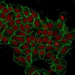 EpCAM/TROP1 Antibody (EGP40/1372) - (ECD), Novus Biologicals 20&mu;g; Unlabeled:Antibodies,