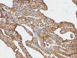 EpCAM/TROP1 Antibody (EGP40/1372) - (ECD), Novus Biologicals 20&mu;g; Unlabeled:Antibodies,