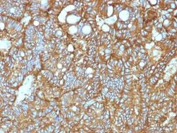 EpCAM/TROP1 Antibody (EGP40/1372) - (ECD), Novus Biologicals 20&mu;g; Unlabeled:Antibodies,