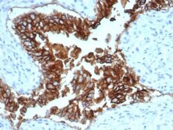 EpCAM/TROP1 Antibody (EGP40/1372) - (ECD), Novus Biologicals 20&mu;g; Unlabeled:Antibodies,