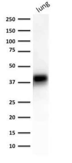 EpCAM/TROP1 Antibody (EGP40/1372) - (ECD), Novus Biologicals 20&mu;g; Unlabeled:Antibodies,