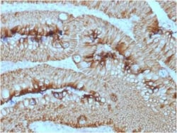 EpCAM/TROP1 Antibody (EGP40/1373) - (ECD), Novus Biologicals:Antibodies:Primary