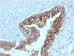 EpCAM/TROP1 Antibody (EGP40/1373) - (ECD), Novus Biologicals:Antibodies:Primary
