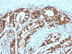 EpCAM/TROP1 Antibody (EGP40/1373) - (ECD), Novus Biologicals:Antibodies:Primary