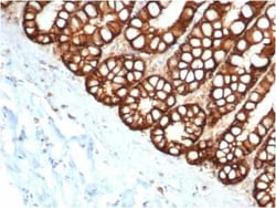 EpCAM/TROP1 Antibody (EGP40/1373) - (ECD), Novus Biologicals:Antibodies:Primary