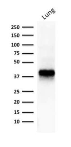EpCAM/TROP1 Antibody (EGP40/1373) - (ECD), Novus Biologicals:Antibodies:Primary