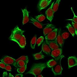 EpCAM/TROP1 Antibody (EGP40/1555R) - (ECD), Novus Biologicals 100&mu;g;