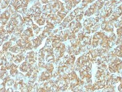 EpCAM/TROP1 Antibody (EGP40/1555R) - (ECD), Novus Biologicals 100&mu;g;